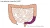 LAR-operatie (Low Anterior Resectie)