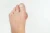 Een photo van hallux valgus