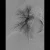Pulmonalisangiografie