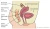 Endometriose